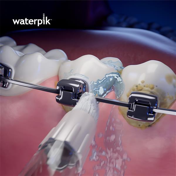 Whitening Orthodontic Tip WOD-2E | Replacement Tips - Image 3
